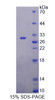 Human Recombinant DIX Domain Containing Protein 1 (DIXDC1)