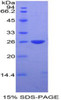 Mouse Recombinant DIX Domain Containing Protein 1 (DIXDC1)