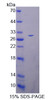 Human Recombinant Deltex Homolog 1 (DTX1)