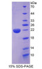 Human Recombinant Growth Arrest And DNA Damage Inducible Protein Beta (GADD45b)