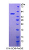 Human Recombinant Interferon Inducible Protein 35 (IFI35)