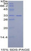 Mouse Recombinant Insulin Like Growth Factor 2 mRNA Binding Protein 2 (IGF2BP2)