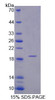 Human Recombinant Inositol Polyphosphate-4-Phosphatase Type I 107kDa (INPP4A)