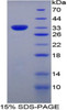 Human Recombinant Myxovirus Resistance 1 (MX1)