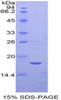 Mouse Recombinant Semaphorin 3A (SEMA3A)