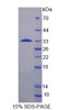 Human Recombinant Ribosomal Protein S6 Kinase Beta 1 (RPS6Kb1)