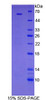 Human Recombinant Ribosomal Protein S6 Kinase Beta 2 (RPS6Kb2)