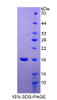 Human Recombinant RCC1 And BTB Domain Containing Protein 2 (RCBTB2)