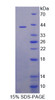 Mouse Recombinant Secreted Ly6/uPAR Related Protein 1 (SLURP1)