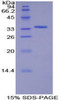 Human Recombinant Salt Inducible Kinase 2 (SIK2)