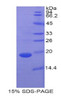 Pig Recombinant Retinol Binding Protein 7, Cellular (RBP7)