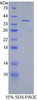 Mouse Recombinant Keratin 71 (KRT71)