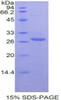 Mouse Recombinant T-Cell Immunoreceptor With Ig And ITIM Domains Protein (TIGIT)