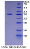Rat Recombinant T-Cell Immunoreceptor With Ig And ITIM Domains Protein (TIGIT)