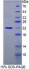 Human Recombinant Amy1 Associated Protein Expressed In Testis (AAT1)