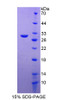 Human Recombinant Progesterone Immunomodulatory Binding Factor 1 (PIBF1)