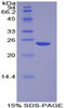Human Recombinant Non Metastatic Cells 6, Protein Expressed In (NME6)