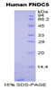 Human Recombinant Fibronectin Type III Domain Containing Protein 5 (FNDC5)