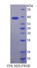 Human Recombinant Pim-3 Oncogene (PIM3)