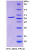 Human Recombinant Sp140 Nuclear Body Protein (SP140)