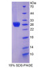 Mouse Recombinant Thrombospondin Type I Domain Containing Protein 7A (THSD7A)