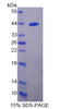 Human Recombinant A Disintegrin And Metalloproteinase With Thrombospondin 16 (ADAMTS16)