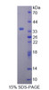 Human Recombinant TAK1 Like Protein (TAK1L)