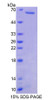 Human Recombinant Myosin Heavy Chain 7B, Cardiac Muscle Beta (MYH7B)