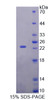 Rat Recombinant Retinol Binding Protein 5, Cellular (RBP5)