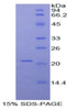 Mouse Recombinant A Disintegrin And Metalloproteinase With Thrombospondin 12 (ADAMTS12)