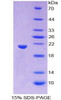 Human Recombinant Wingless Type MMTV Integration Site Family, Member 11 (WNT11)