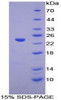 Human Recombinant Linker For Activation Of T-Cells Family, Member 2 (LAT2)