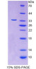 Human Recombinant Translocase Of Outer Mitochondrial Membrane 70A (TOMM70A)