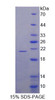 Human Recombinant Ribosomal Protein L23A (RPL23A)