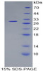 Human Recombinant Proteasome 26S Subunit, Non ATPase 10 (PSMD10)