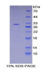 Human Recombinant LIM And Senescent Cell Antigen Like Domains Protein 1 (LIMS1)