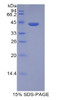 Human Recombinant Histone Cluster 1, H2ad (HIST1H2AD)