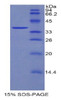 Mouse Recombinant Dickkopf Related Protein 4 (DKK4)