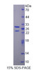 Human Recombinant BMX Non Receptor Tyrosine Kinase (BMX)