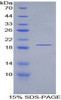 Human Recombinant Poly A Binding Protein Cytoplasmic 1 Like Protein (PABPC1L)