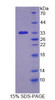 Human Recombinant Echinoderm Microtubule Associated Protein Like Protein 2 (EML2)