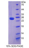 Human Recombinant Family With Sequence Similarity 5, Member C (FAM5C)