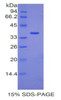 Mouse Recombinant Angiopoietin Like Protein 7 (ANGPTL7)