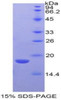 Mouse Recombinant Ly1 Antibody Reactive Homolog (LYAR)