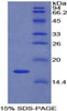 Rat Recombinant Ly1 Antibody Reactive Homolog (LYAR)