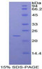 Human Recombinant RAD54 Like Protein 2 (RAD54L2)