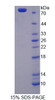 Mouse Recombinant Keratin 28 (KRT28)