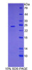 Mouse Recombinant Folate Receptor 4 Delta (FOLR4)