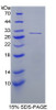 Mouse Recombinant Ubiquitin Carboxyl Terminal Hydrolase L4 (UCHL4)