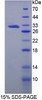 Rat Recombinant Methyltransferase Like Protein 21C (METTL21C)